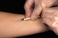 Najlepšou prevenciou proti tuberkulóze je očkovanie