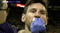 Messiho krvavé zranění v obličeji
