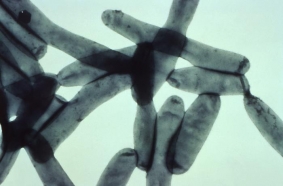Legionella pneumophila v elektronovém mikroskopu