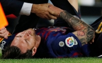 Messi má zlomenou vřetenní kost